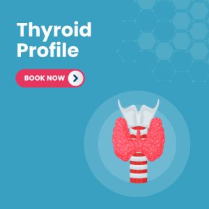 THYROID PROFILES